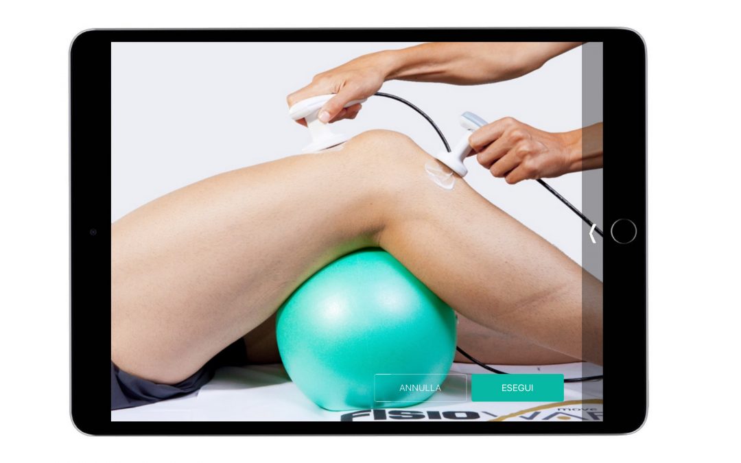 Knee Parallelofemoral