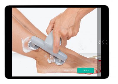 Osteo-Tendineo Edema osseo superficiale