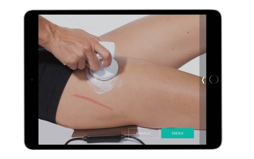 Artropatia dell’anca