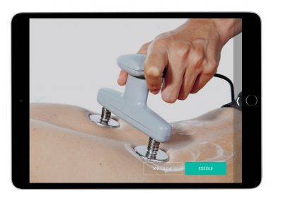 Artropatia Dorso Lombare