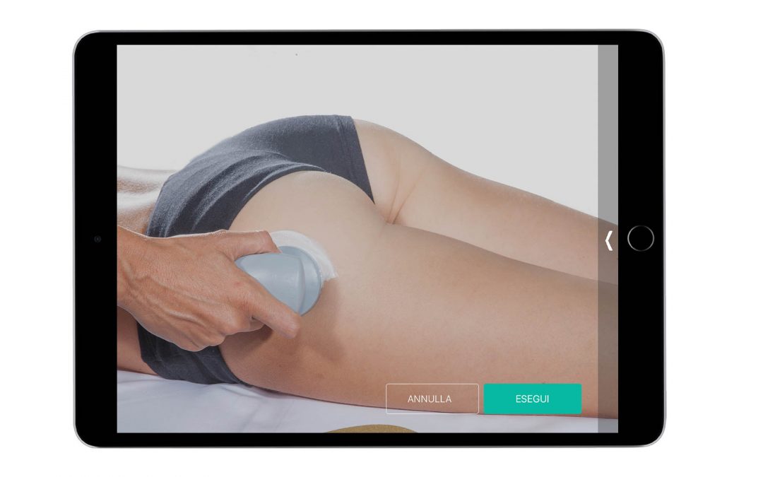 Pannicolopatia edemato-fibrosa