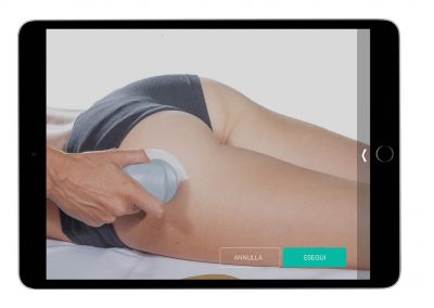 Pannicolopatia edemato-fibrosa