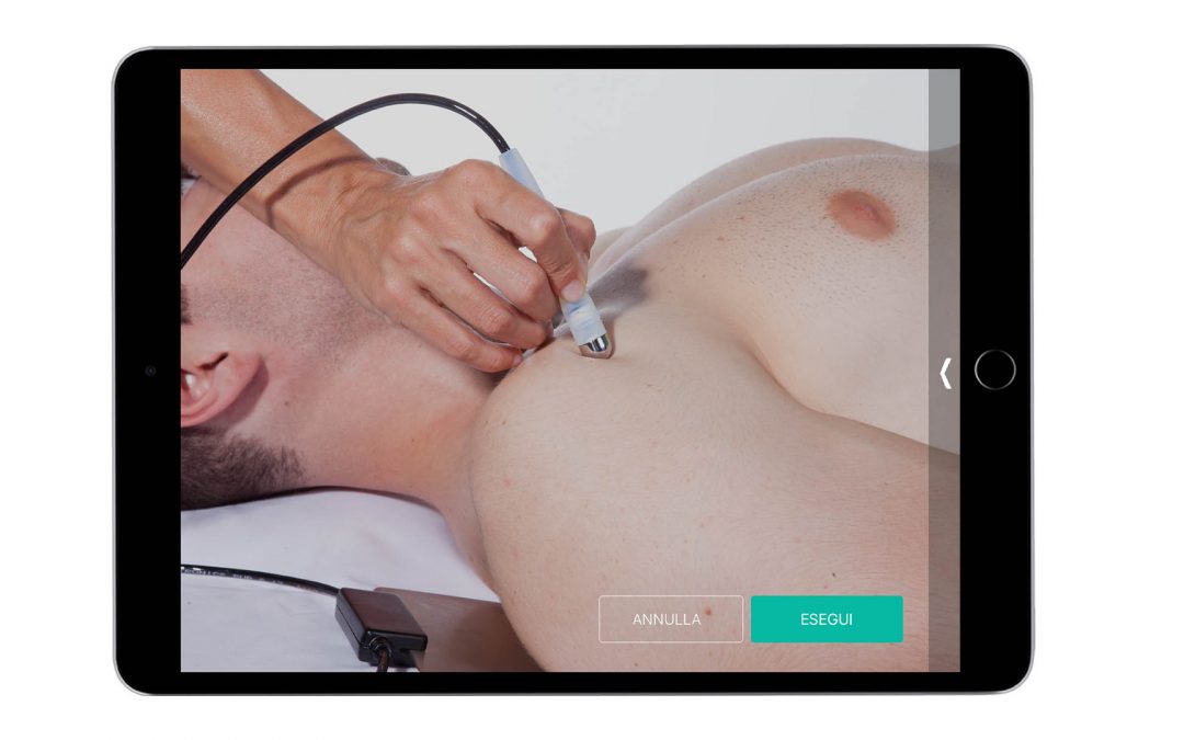 Tendinopatia del CLB – Trattamento Unipointer