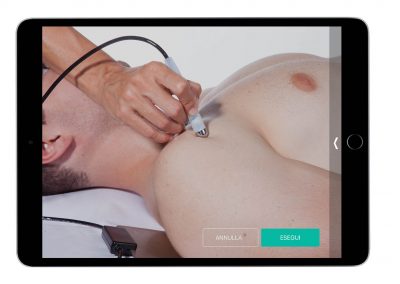 Tendinopatia del CLB – Trattamento Unipointer