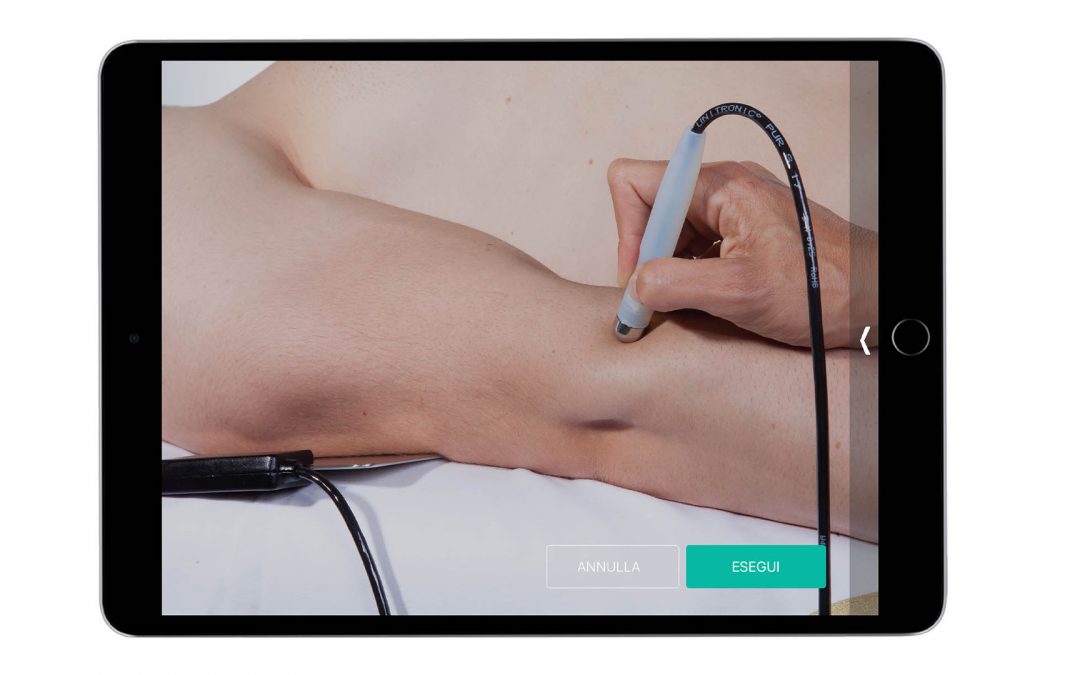 Trigger Point – Tendini, estensori della mano