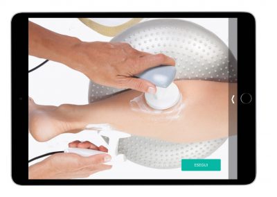 Tendinopatia Achillea