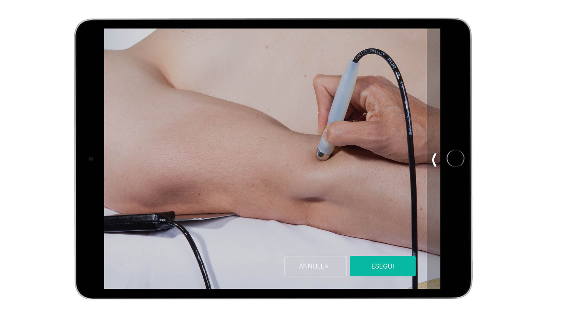 Puntos Gatillo de la mano