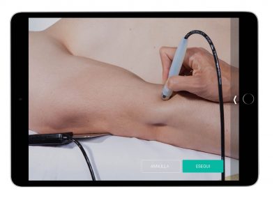 Trigger Points – Tendons