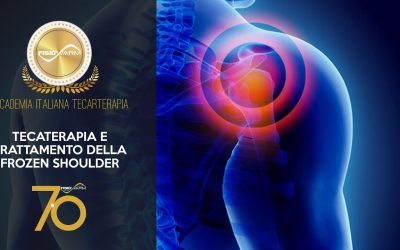 Tecarterapia e trattamento della Frozen Shoulder