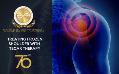 Treating frozen shoulder with tecar therapy