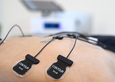 Tecarterapia - Trattamento della Spalla con Octopus