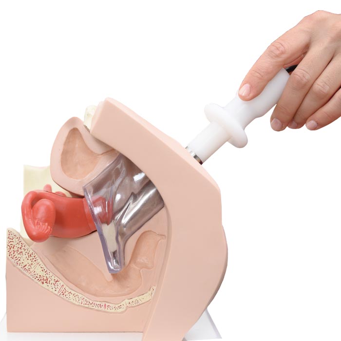 Intimity gel for probes