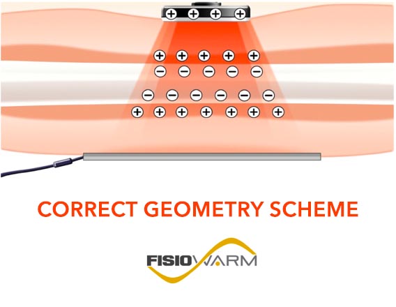 Tecar therapy correct geometry