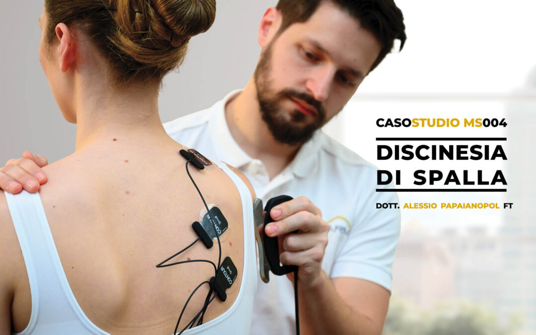 Caso Studio Discinesia di Spalla