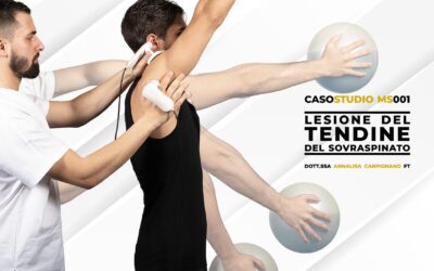 Caso studio lesione del tendine del sovraspinato