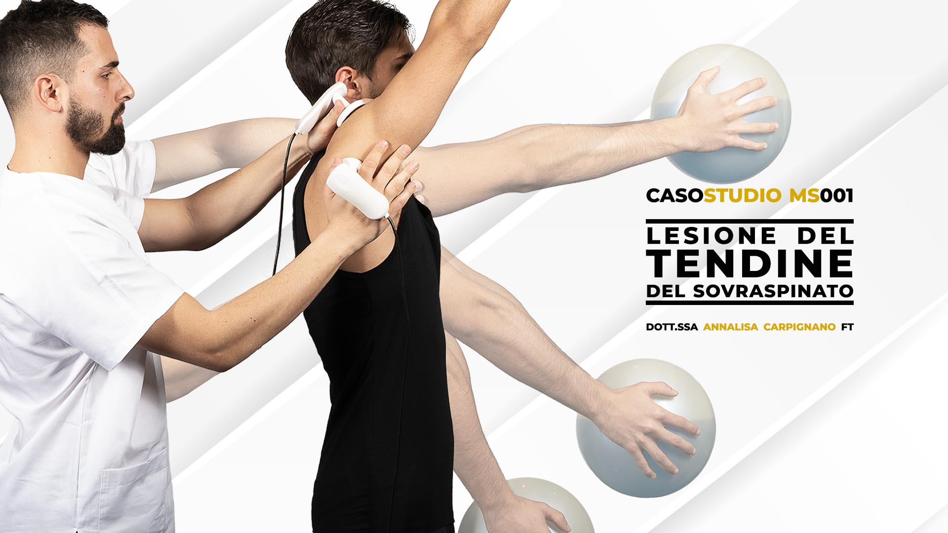 Lesione tendine sovraspinato tecarterapia